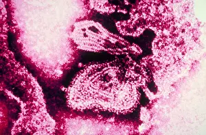Tems Prints: Mumps Virus (TEM)