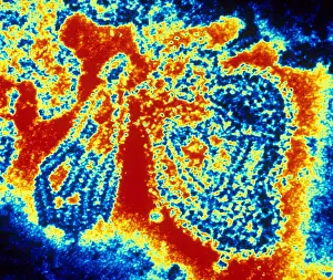 Virus Prints: Mumps Virus (TEM)