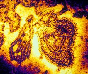 Mumps Virus (TEM)