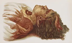 Instrument Prints: Murder Victim, 1898