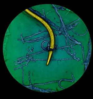 Constricting Prints: Nematode Snared by Predatory Fungus (LM) under a microscope