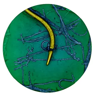 Ring Prints: Nematode Snared by Predatory Fungus (LM) under a microscope