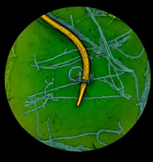 Ring Prints: Nematode Snared by Predatory Fungus (LM) under a microscope
