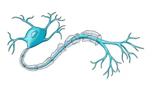 Demyelination Prints: Nerve Demyelination of the myelin sheath