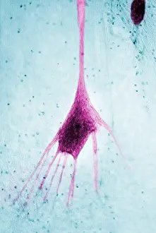 Fibers Prints: Nervous System, Human Neuron, light micrograph