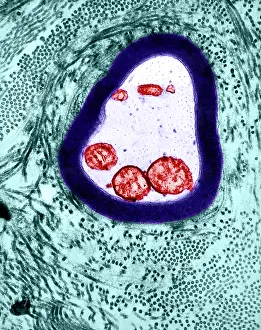Neurone Prints: Nervous System, Myelinated Axon, TEM