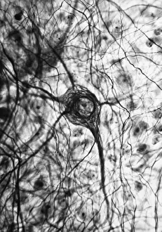 Cord Prints: Nervous System, Neuron, TEM