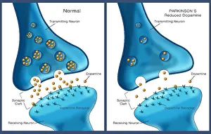 Synapse Prints: Neuron synapse affected by Parkinson's disease shows diminished dopamine transmission