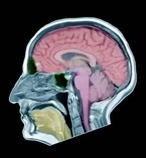 Magnetic Prints: Normal Adult Male Brain, MRI
