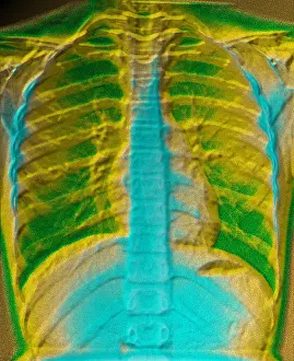 Chest Prints: A normal chest X-ray