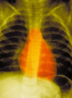 Research Prints: Normal chest x-ray