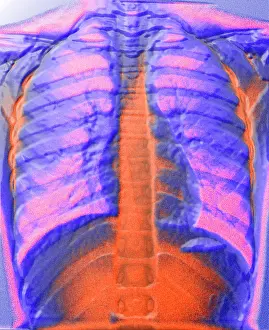 Chest Prints: A normal chest X-ray