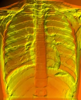 Chest Prints: A normal chest X-ray