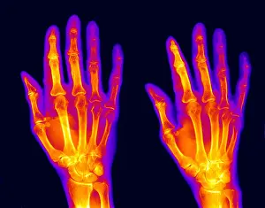 Normal Prints: Normal Hand