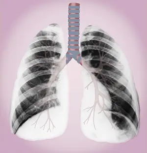 Tubes Prints: Normal lungs