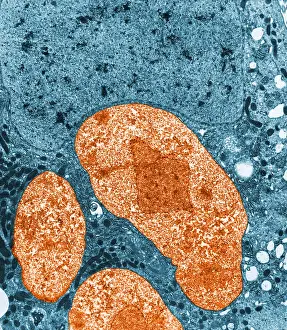 Pathogen Prints: Nosema apis (TEM)