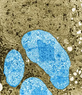 Pathogen Prints: Nosema apis (TEM)