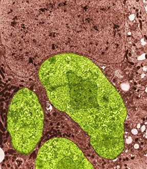 Pathogen Prints: Nosema apis (TEM)