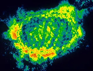 Pathogen Prints: Orf Virus (TEM)