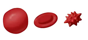 Pressure Prints: Osmotic Pressure on Blood Cells