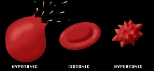 Explode Prints: Osmotic Pressure on Blood Cells
