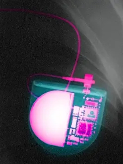 Technology Prints: Pacemaker