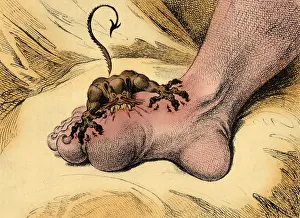 Medical Prints: The Pain of Gout, 1799