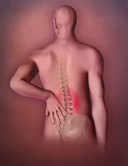 Back Prints: Back Pain, Illustration