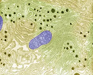 Pancreas, Endoplasmic Reticulum, TEM