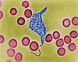 Microorganisms Prints: Phagocytosis, WBC Ingesting Streptococcus, light micrograph