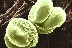 Grain Prints: Pine Pollen, under a microscope (SEM)