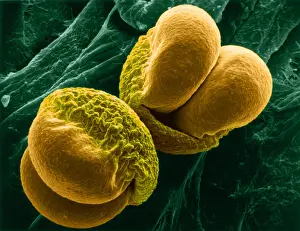 Medical Prints: Pine Pollen, scanning electron micrograph