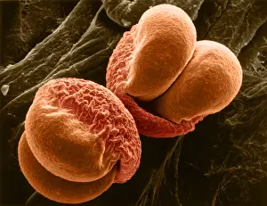 Grain Prints: Pine Pollen, scanning electron micrograph