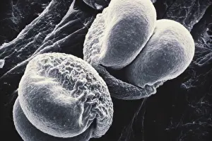 Pine Pollen (SEM)
