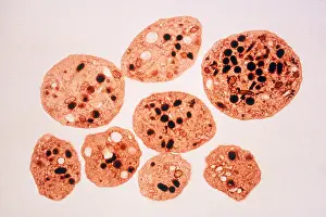 Tems Prints: Platelets, TEM