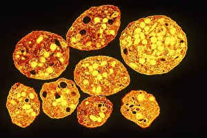 Tems Prints: Platelets, TEM