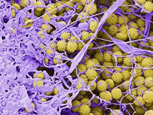 Agricultural Prints: Pollen Grains with Fungal Growth, scanning electron micrograph