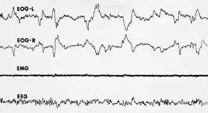 Sleep Prints: Polygraph Tracings of REM Sleep