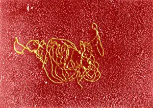 Gram Prints: Polymerase Reaction, DNA with E. coli RNA, TEM