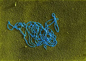 Gram Prints: Polymerase Reaction, DNA with E. coli RNA, TEM