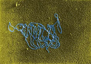 Gram Prints: Polymerase Reaction, DNA with E. coli RNA, TEM