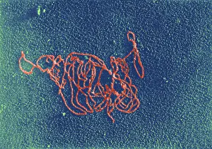 Gram Prints: Polymerase Reaction, DNA with E. coli RNA, TEM