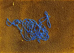 Pathogen Prints: Polymerase Reaction, DNA with E. coli RNA, TEM