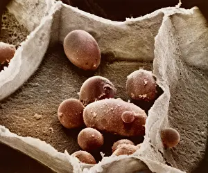 Potato Prints: Potato cell with starch granules
