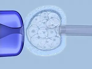 Research Prints: Preimplantation genetic diagnosis