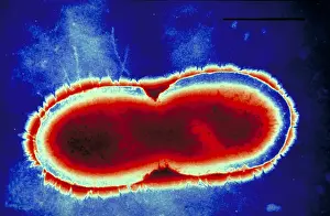 2000 Prints: Pseudomonas cepacea
