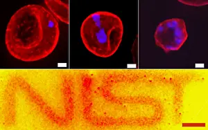 Progression Prints: Quantum Dots, Malaria Progression, under a microscope (SEM)
