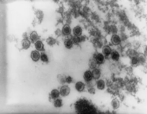 Rauscher Leukemia Virus