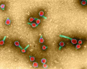 Histopathic Prints: Rauscher Leukemia Virus, TEM