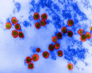 Rauscher Leukemia Virus, TEM